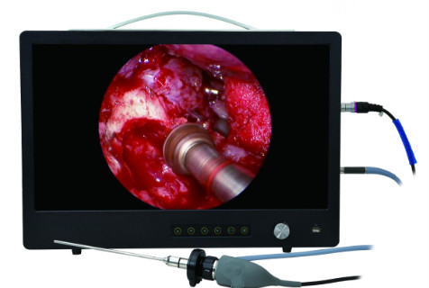 Portable endoscopy camera Imaging System Compatible with both rigid and flexible endoscopes