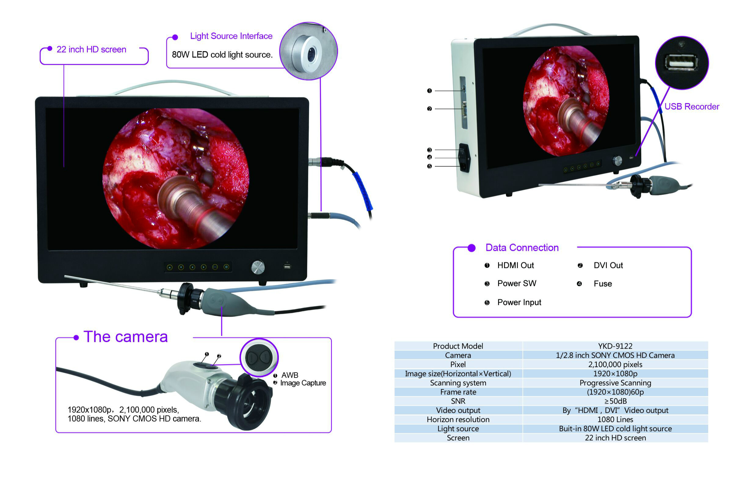 Portable Full HD endoscopy camera system