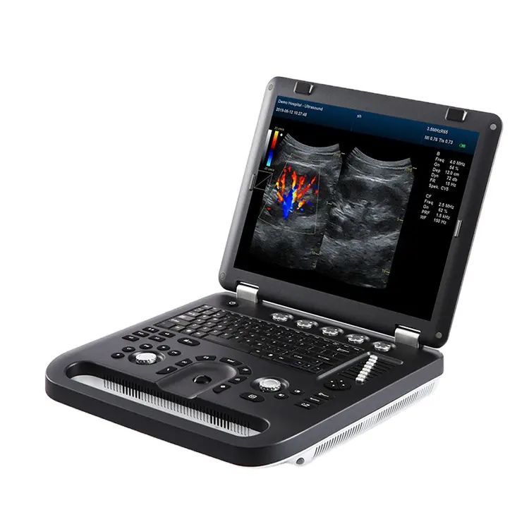 M60 Color Doppler ultrasound Scanner 
