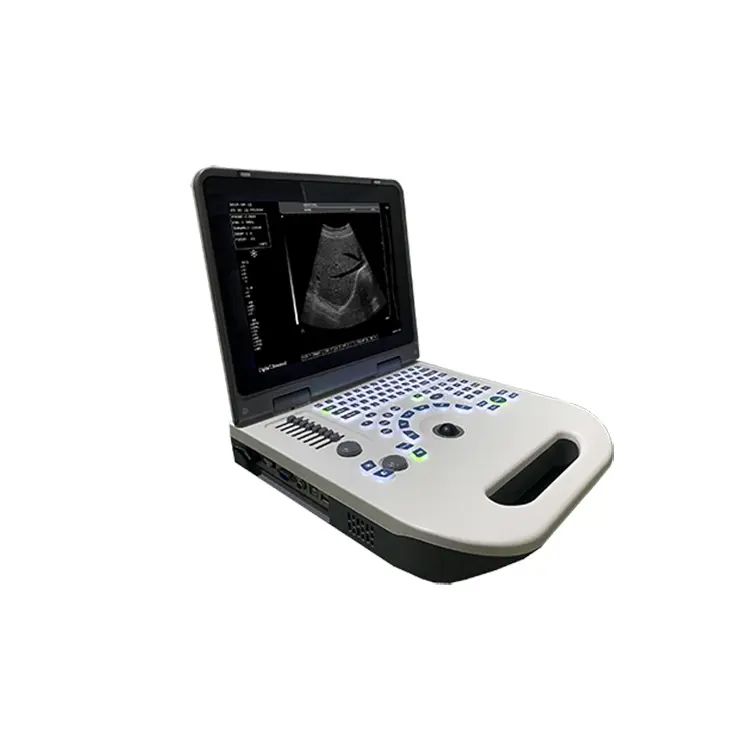 5510 Portable B/W Ultrasound Scanner